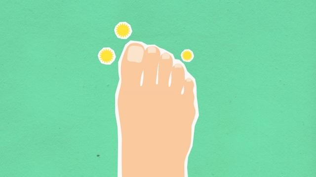 How to Cure Fungal Infection on Skin Naturally? cover picture