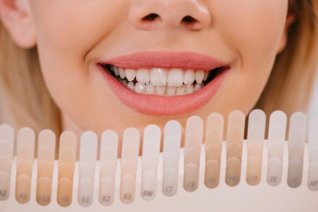 7 Facts on Whitening Teeth Safely cover picture