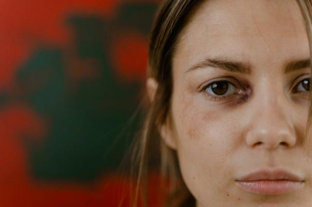 What is Trauma Informed Care & How Does it Benefit Patients? cover picture