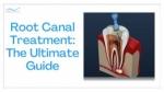 Root Canal Treatment: The Ultimate Guide cover picture