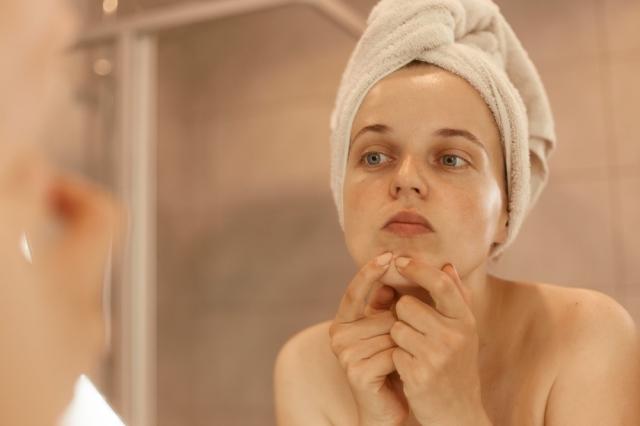 How are abscesses and acne different? cover picture