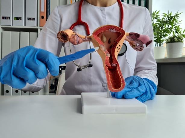 5 Signs You Might Need Ruptured Ovarian Cyst Surgery cover picture