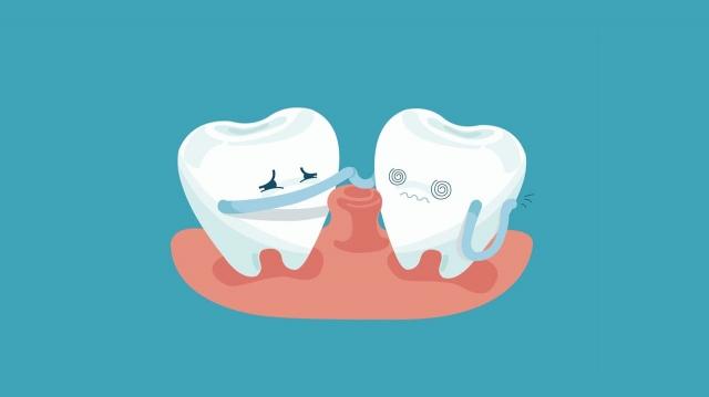 7 Common Myths About Gingivitis: Debunking Oral Health Misconceptions cover picture