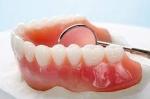 Dentist in Sydney: The Pros and Cons of Partial Denture cover picture