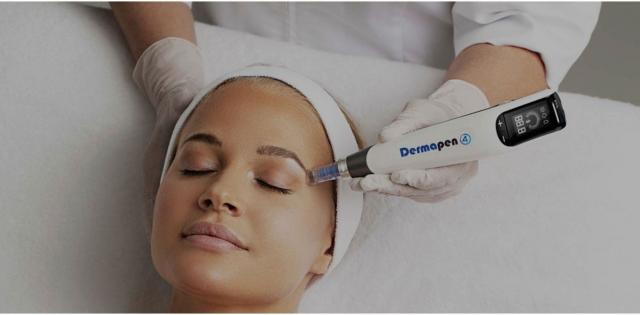 Unveiling the Magic of Microneedling: A Comprehensive Guide to Flawless Skin with Dermapen cover picture