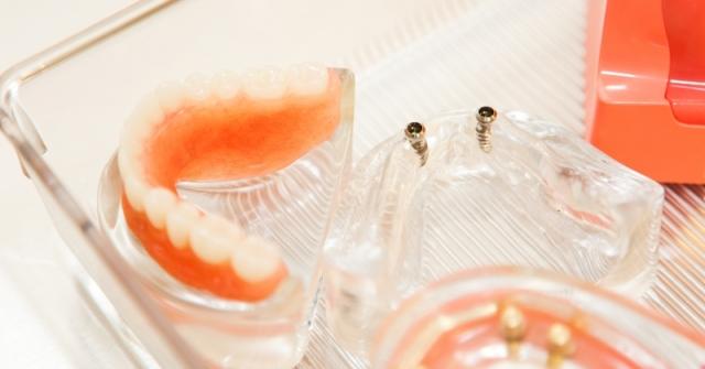Dental Products Online – 4 Key Points You Need To Know cover picture