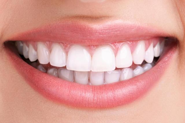 How to Whiten Your Teeth in a Quick and Easy Way cover picture