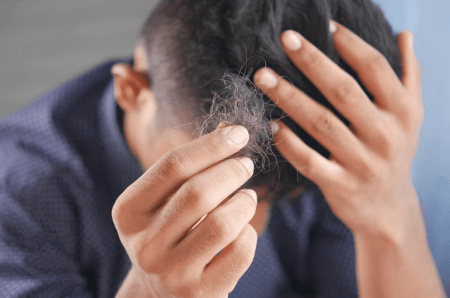 How Much Does Scalp Micropigmentation Cost in Canada? cover picture
