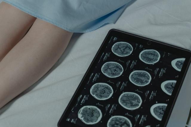 What to Do After Suffering a Traumatic Brain Injury cover picture