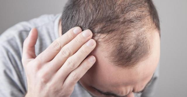 What is the reason for hair falling out? cover picture