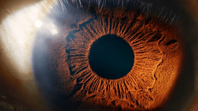 Life After Macular Hole Surgery: Recovery, Vision Improvement, and What Else You Need to Know cover picture