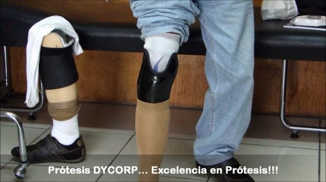 Transtibial vs. Transradial Prostheses: Understanding Upper and Lower Limb Differences cover picture