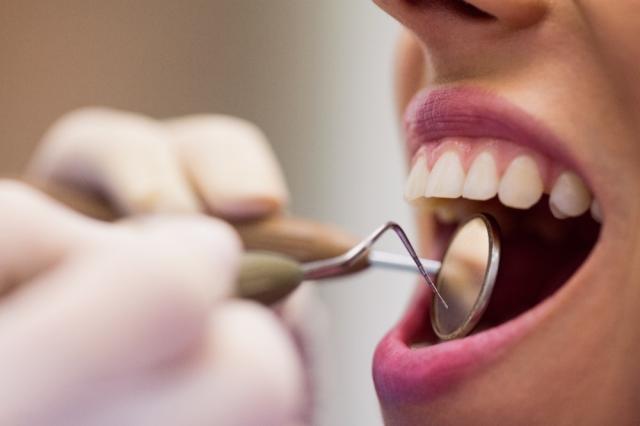 What To Do When You Break a Tooth in an Accident cover picture