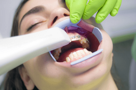 What You Need To Know About Family Dentistry cover picture