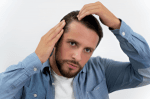 Understanding Hair Transplant Costs in Philadelphia, Pennsylvania: What to Expect cover picture