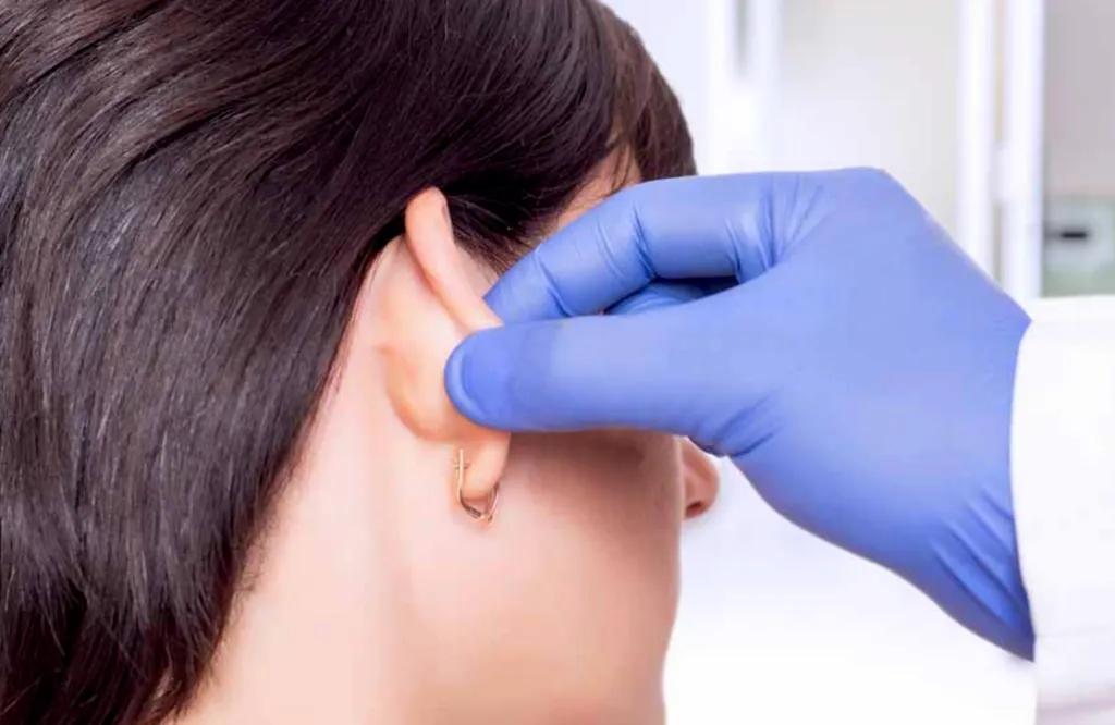 What Patients Should Know Before Considering Otoplasty cover picture