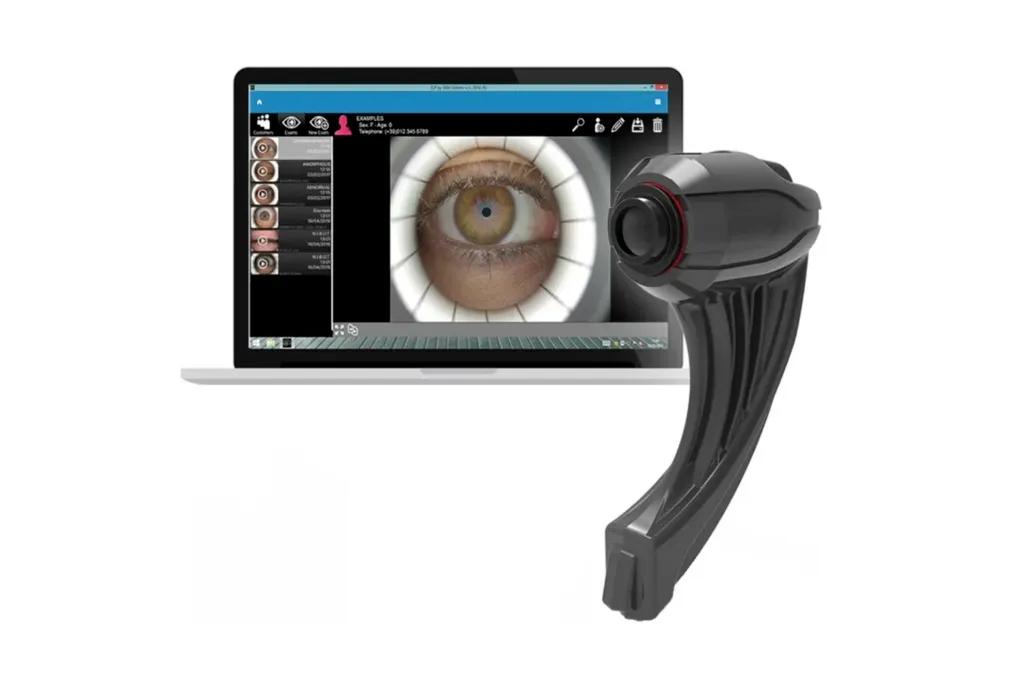 How Technology Is Improving Dry Eye Detection and Patient Management cover picture