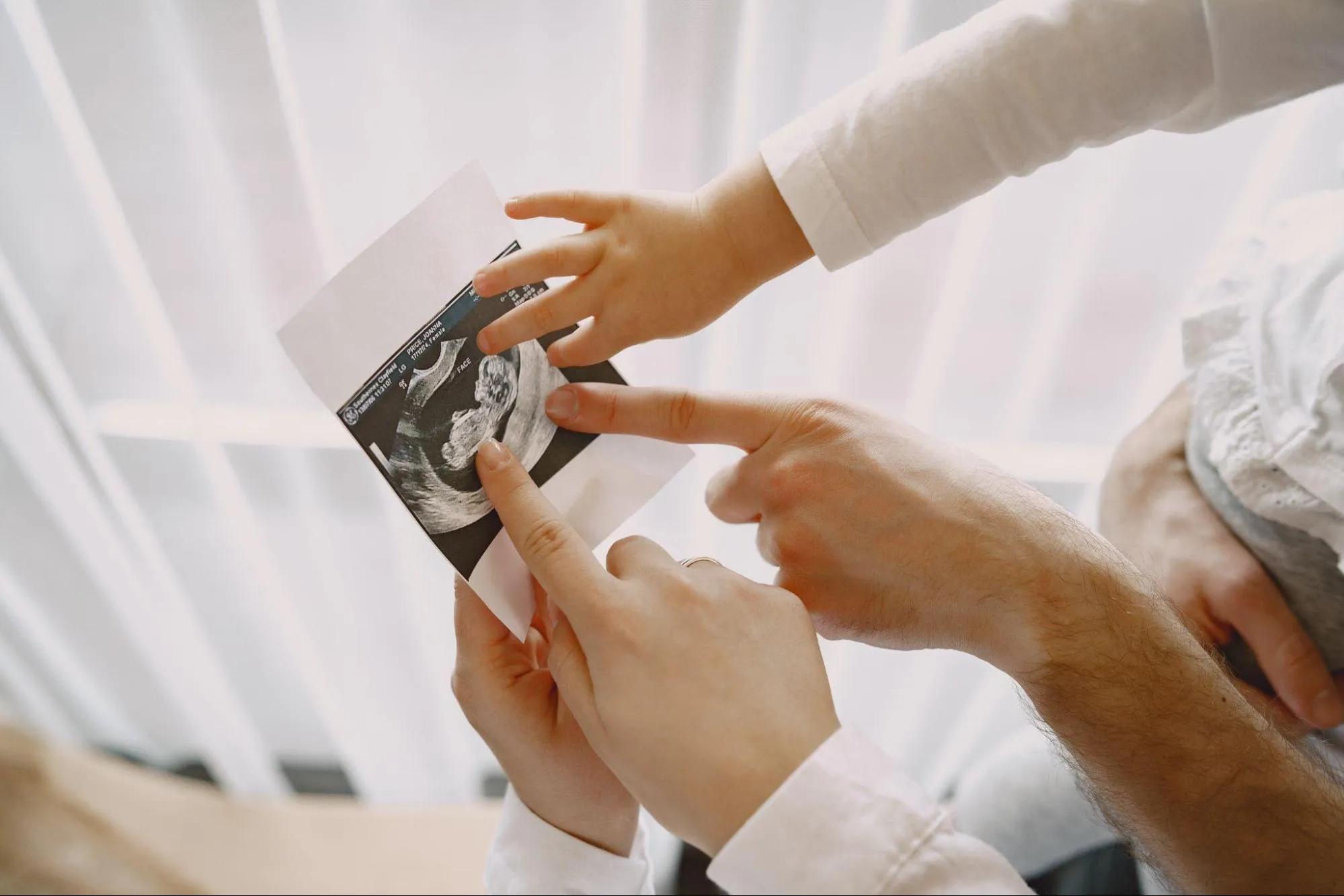IVF Costs in Delhi