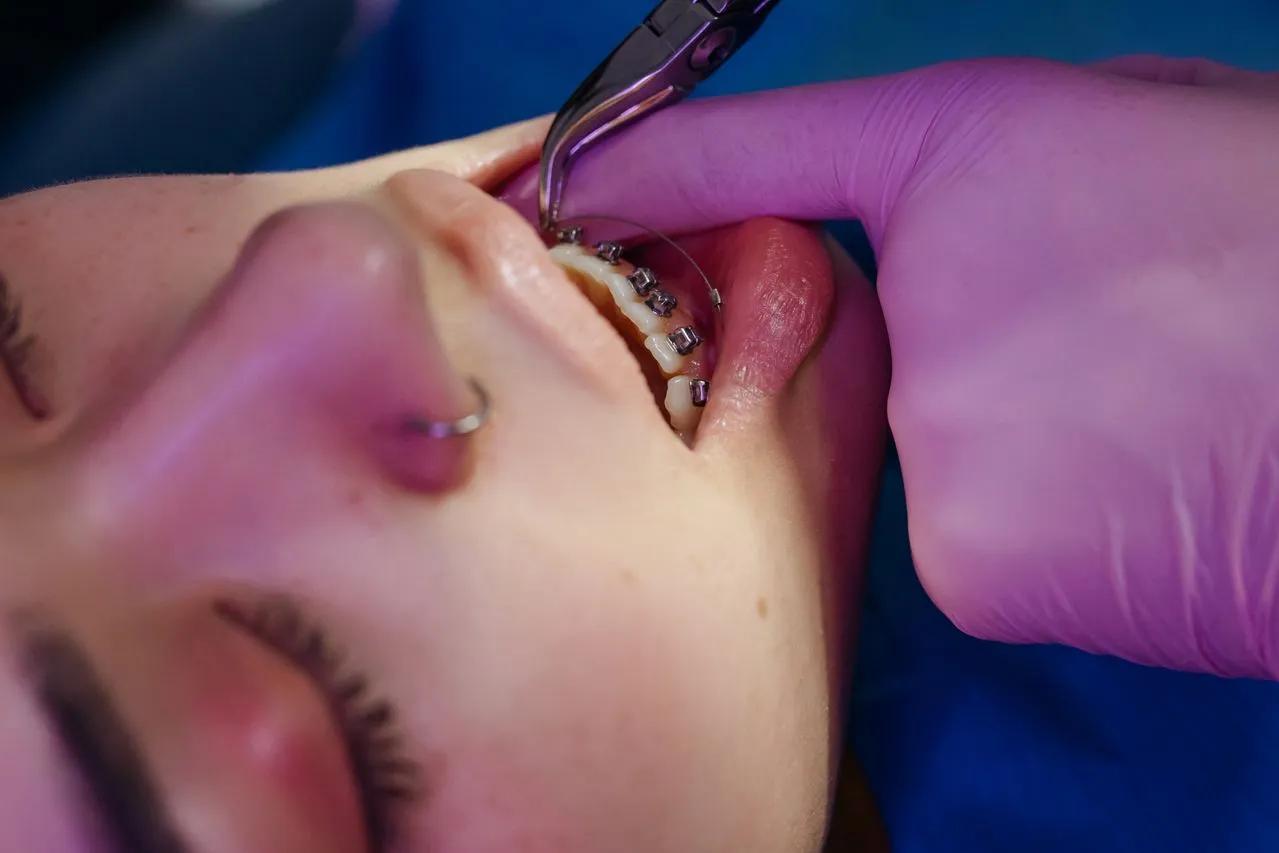 Daily wellbeing with braces