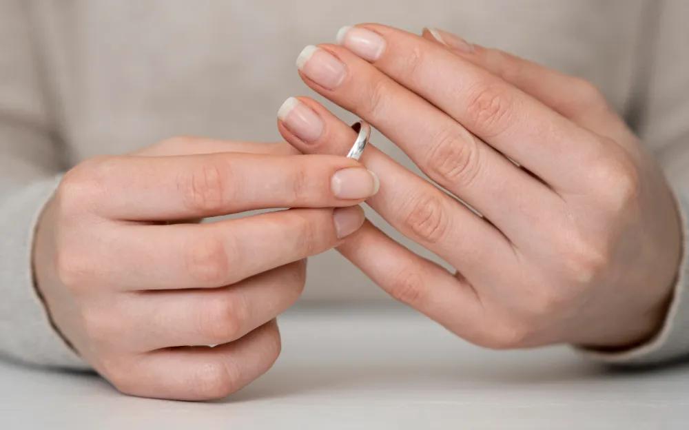 Do Stainless Steel Rings Turn Your Finger Green? The Real Answer cover picture