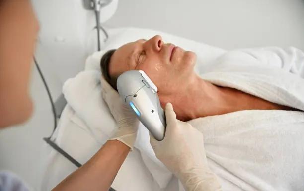 What Morpheus8 Treatment In San Jose Actually Does To Your Skin cover picture