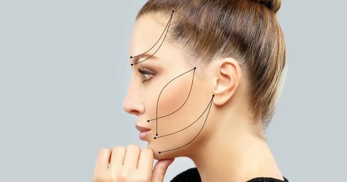 How Endolift in Miami Tightens Sagging Skin? cover picture