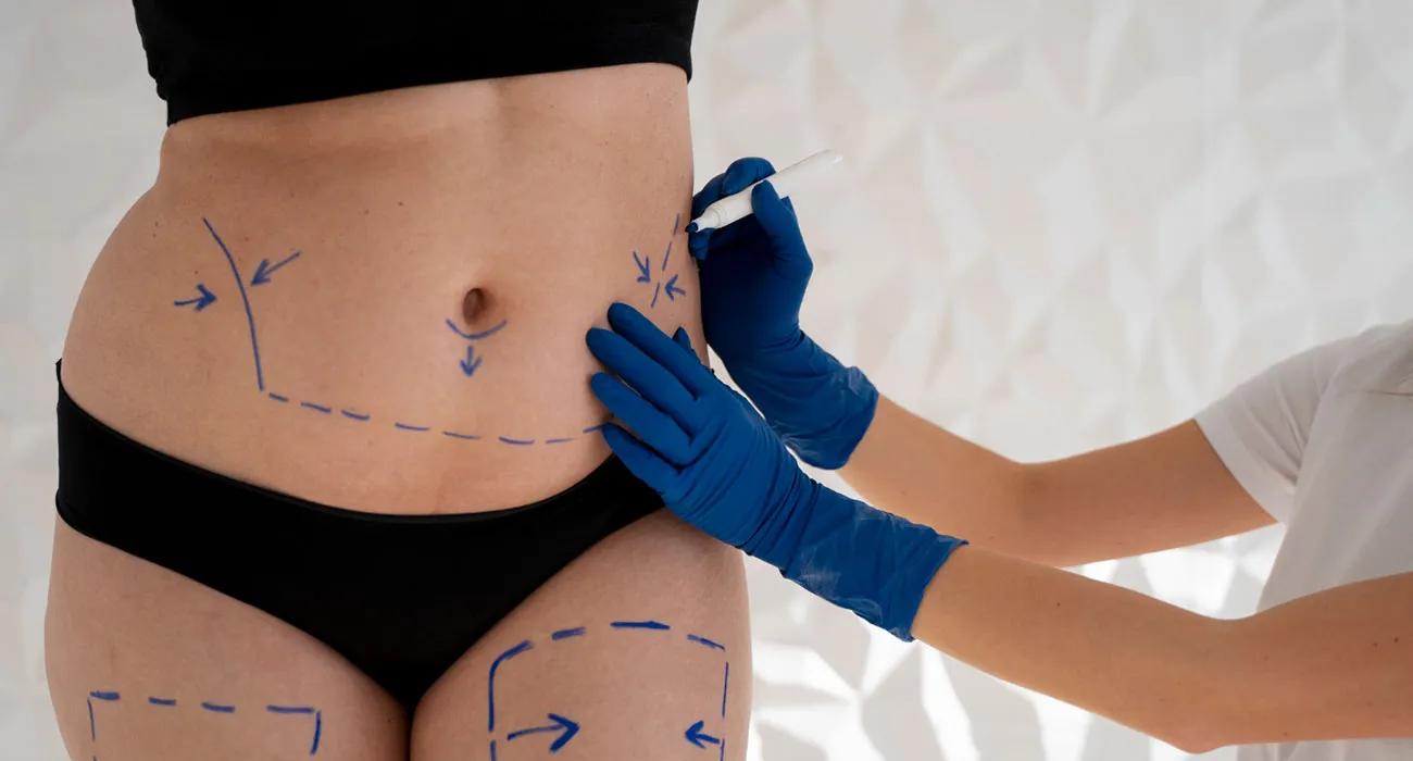 Tummy Tuck San Diego: Restore Your Confidence with Iconic Plastic Surgery cover picture