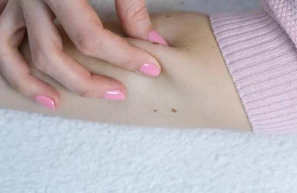 How many sessions are needed for warts removal ? cover picture