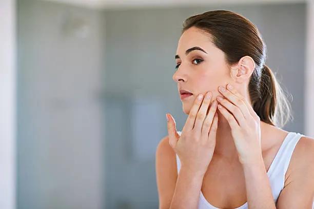 Is Acne Treatment Helpful for Acne Scars and Marks? cover picture