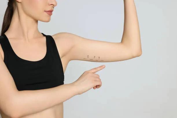 What Causes Flabby Arms and Can Arm Lift Fix Them? cover picture