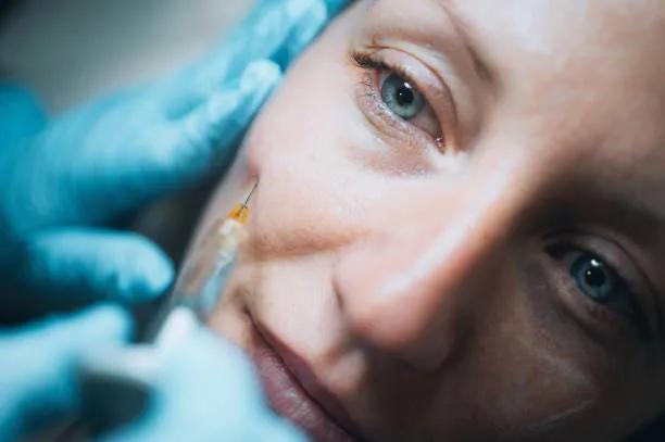 Are Cheek Fillers Suitable for All Face Shapes? cover picture