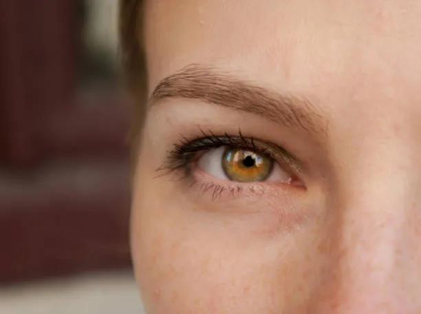How Does Eyelid Surgery Reduce Eye Puffiness? cover picture