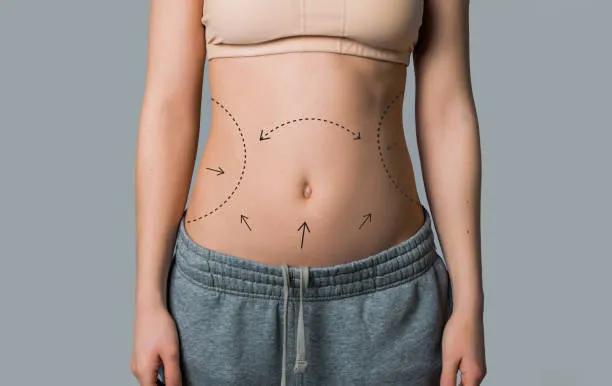 Can Tummy Tuck Be Combined With Other Procedures? cover picture