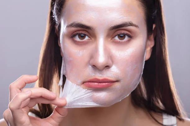 Does Chemical Peel Improve Skin Clarity? cover picture