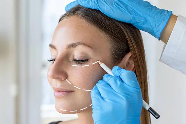 Can Facelifts Improve Facial Balance and Harmony? cover picture