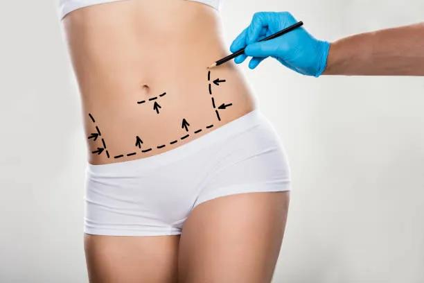 Is Liposuction Safe for All Ages? cover picture