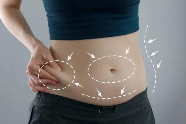 Can Liposuction Help With Body Contouring? cover picture