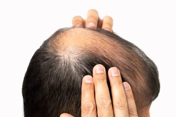 Does GFC Treatment for Hair Strengthen Roots? cover picture