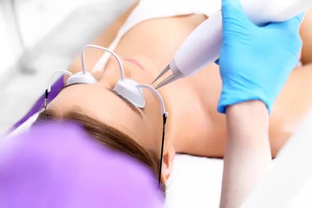 Can Pico Laser Treatment Fade Sun Damage Spots? cover picture