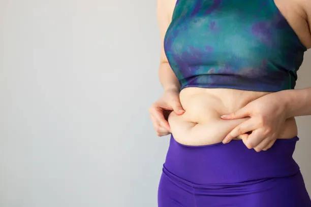 Is Tummy Tuck a Permanent Body Contouring Option? cover picture