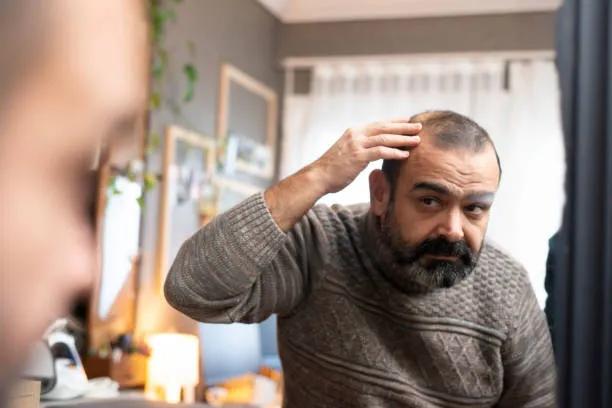 Is Hair Loss Treatment Effective for Alopecia? cover picture