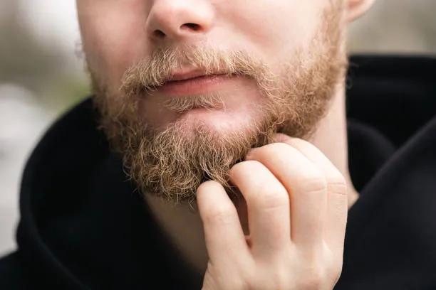 Does Beard Hair Transplant Help Boost Confidence? cover picture