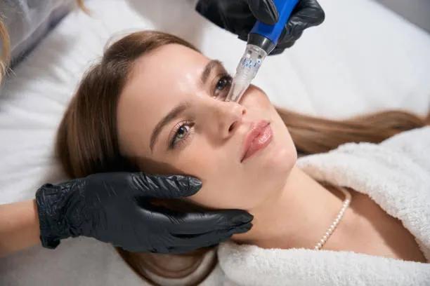 Can Dermapen Microneedling Treat Stretch Marks? cover picture