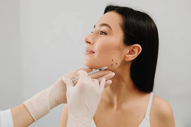 Do Jawline Filler Injections Define Your Face? cover picture