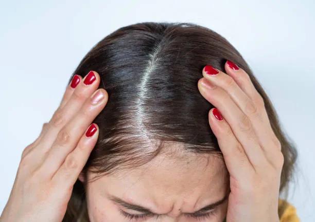 How Do You Choose Hair Loss & Nail Disorders Treatments? cover picture