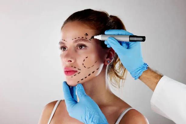 Do Facelifts Reduce Fine Lines Completely? cover picture