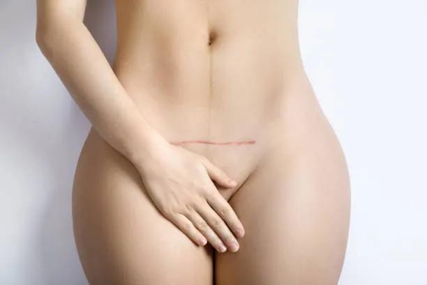 Does Hoodplasty Require Follow-Up Visits? cover picture