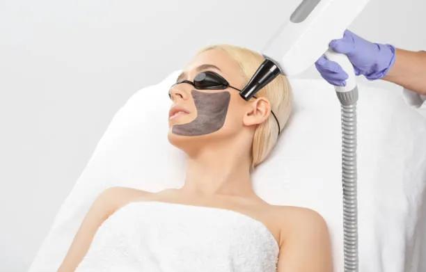 Can Laser Carbon Peel shrink visible pores? cover picture