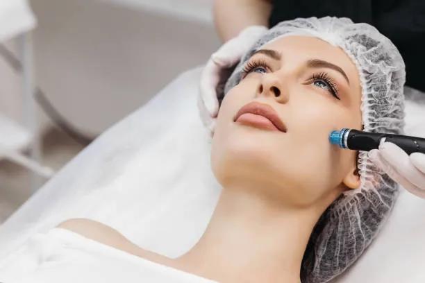 Can Dermapen Microneedling fix sun damage? cover picture