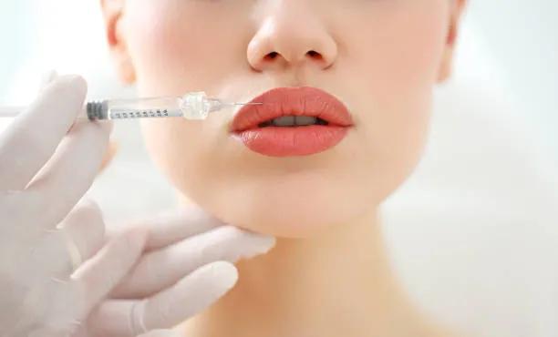 What Are the Benefits of Lip Fillers Injection Today? cover picture